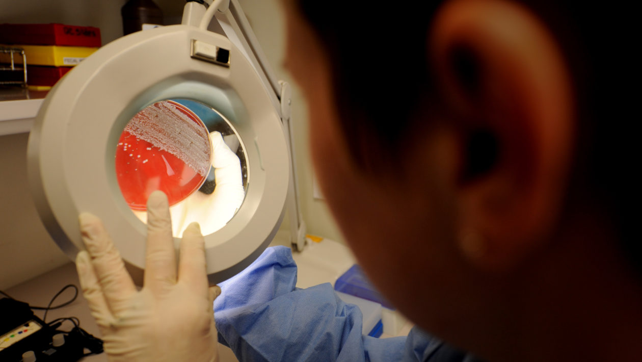 Strep throat symptoms