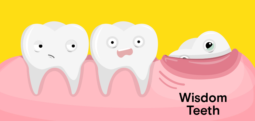 wisdom tooth extraction cost