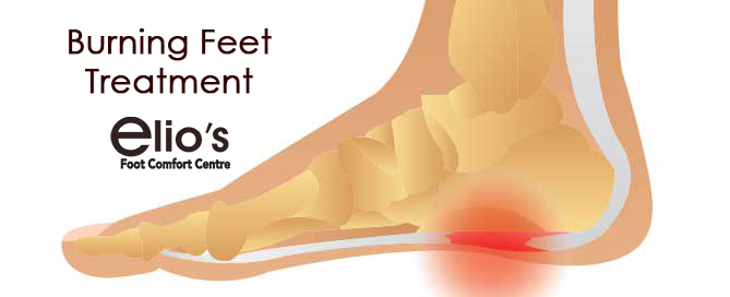 Grierson Gopalan Syndrome is also called Burning Feet Syndrome.