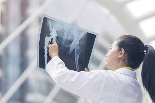 Pelvic and Hip Issues