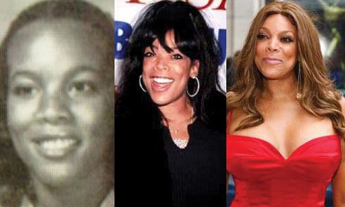 The Botox And the Facelift