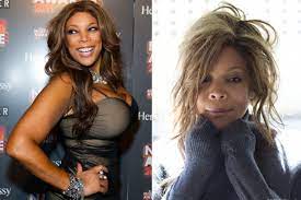 The Honesty of Wendy Williams Regarding Plastic Surgery