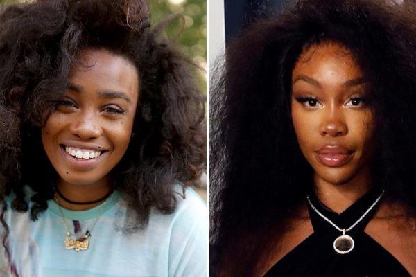 Sza before surgery