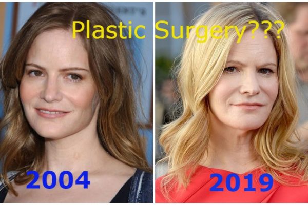 Jennifer Jason Leigh Plastic Surgery