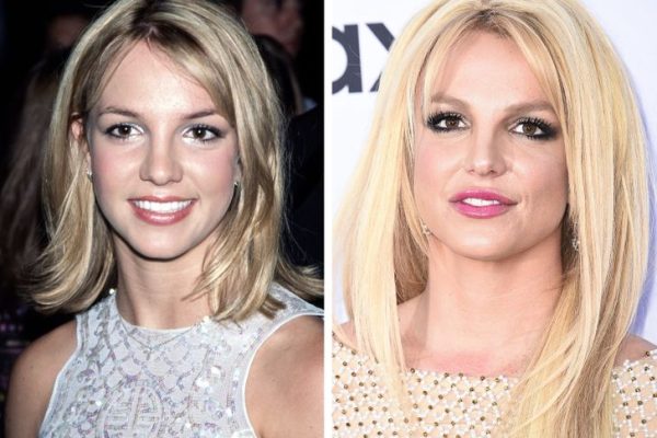 Britney Spears Plastic Surgery