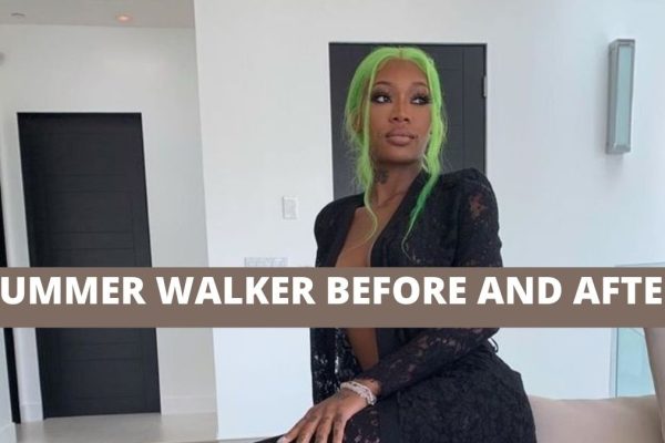 Summer Walker Plastic Surgery