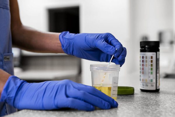 What Are The Most Common Types Of Drug Testing? And Their Differences