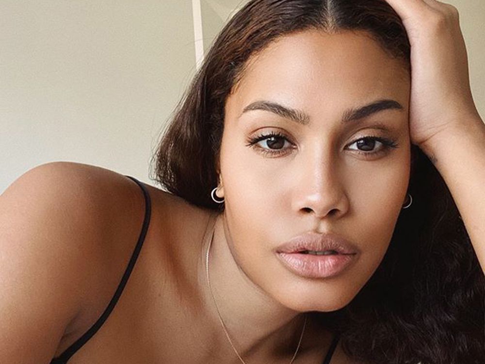 Leyna Bloom before surgery