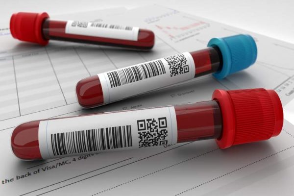 MCHC Blood Test