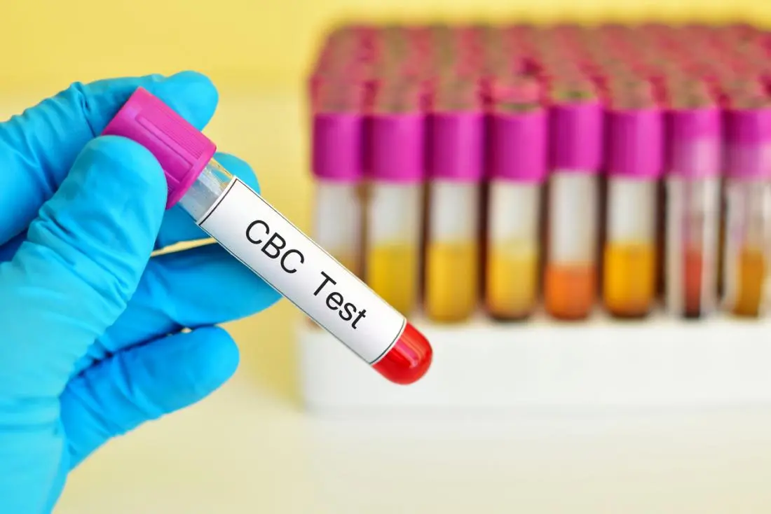Walking you through the procedure of the MCHC blood test