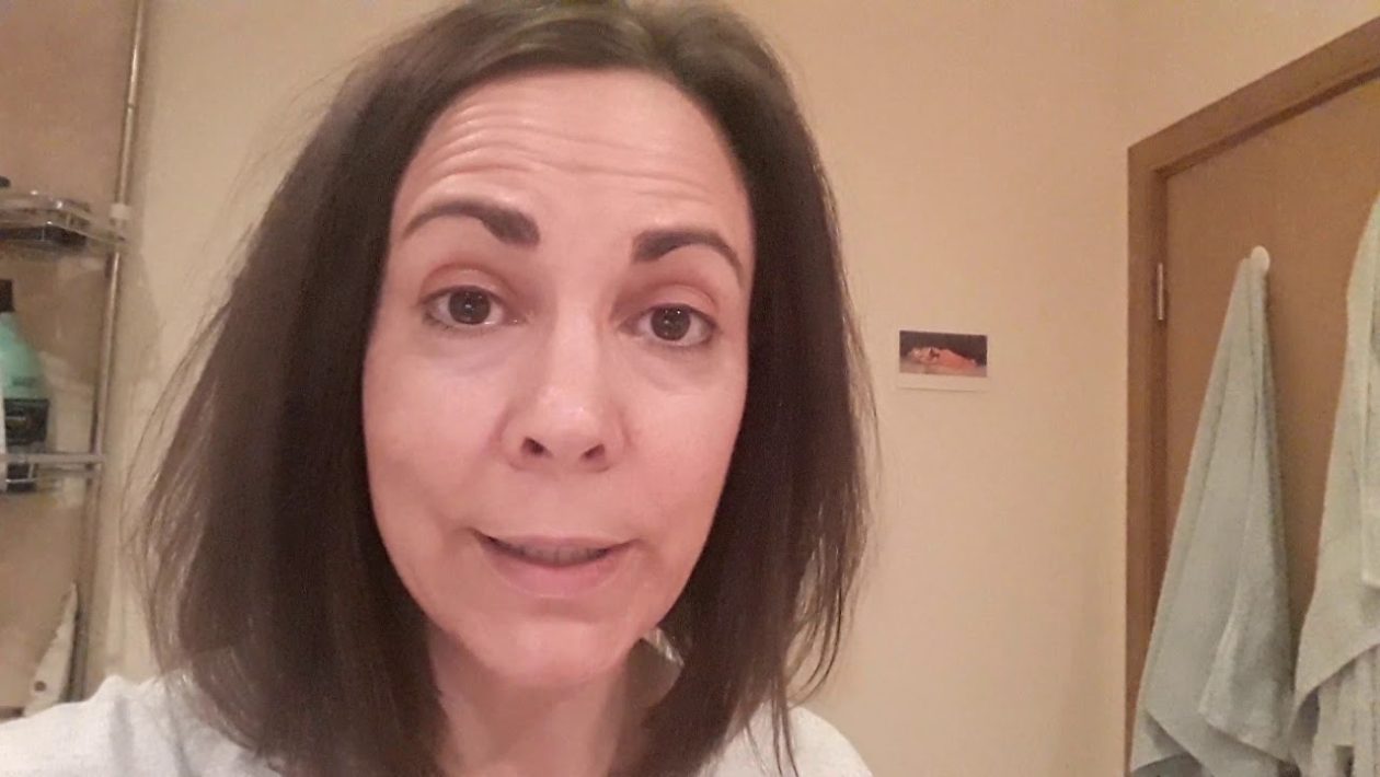 Awaken Your Eyes: NourishMax's Powerful Solution for Under-Eye Bags