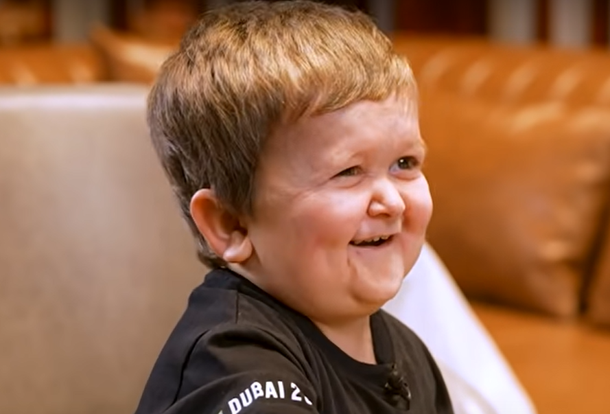 Hasbulla Net Worth, Career, Height, and More